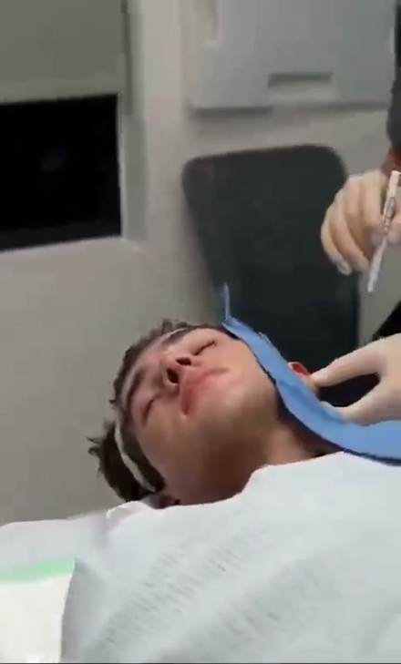 clavicular clip cut by ClipMe
