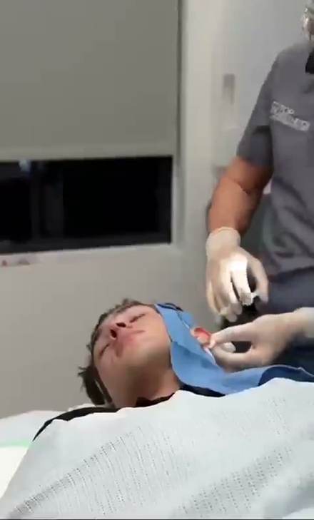 clavicular clip cut by ClipMe