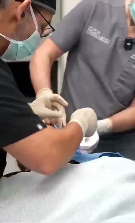 clavicular clip cut by ClipMe