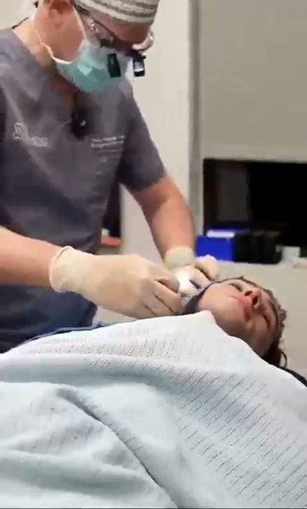 clavicular clip cut by ClipMe