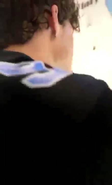 clavicular clip cut by ClipMe